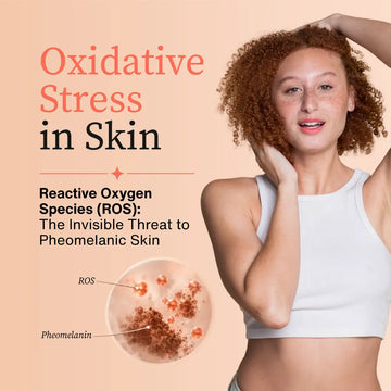 Redhead woman with curly red hair, text reading "Oxidative Stress in Skin: Reactive Oxygen Species (ROS), The Invisible Threat to Pheomelanic Skin"