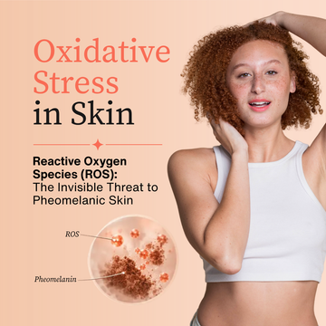 Redhead woman with curly red hair, text reading "Oxidative Stress in Skin: Reactive Oxygen Species (ROS), The Invisible Threat to Pheomelanic Skin"